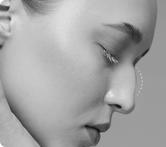 تصویر قبل از درمان