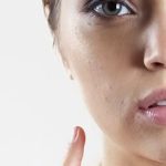 تصویر قبل از درمان