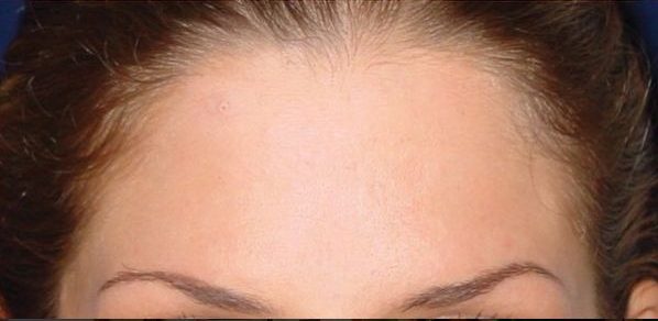 تصویر بعد از درمان