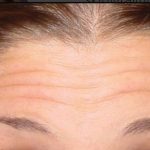 تصویر قبل از درمان