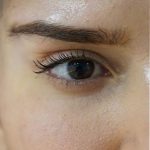 تصویر بعد از درمان