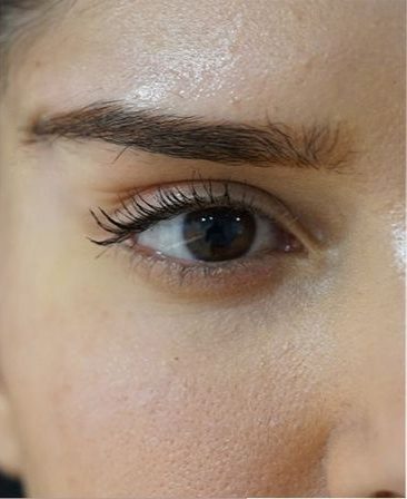 تصویر بعد از درمان