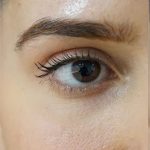 تصویر قبل از درمان