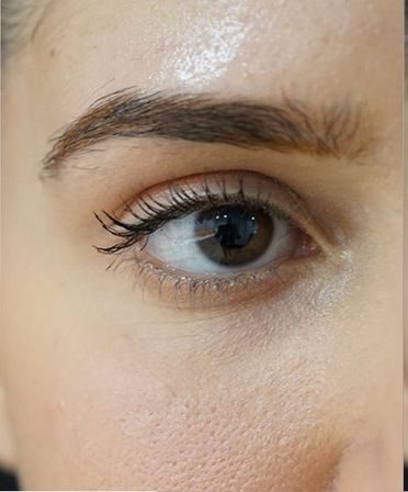 تصویر قبل از درمان