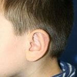 تصویر بعد از درمان