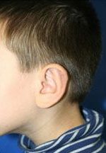 تصویر بعد از درمان