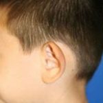 تصویر قبل از درمان