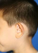 تصویر قبل از درمان