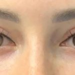 تصویر بعد از درمان