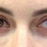 تصویر قبل از درمان