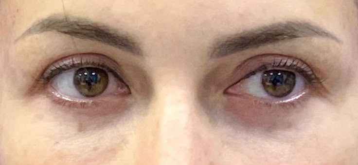 تصویر قبل از درمان